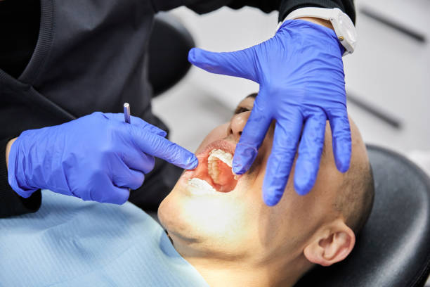 Best Emergency Tooth Extraction in Ansonia, CT